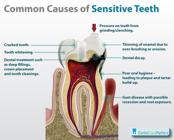 Why Is My Tooth Sensitive To Hot And Cold